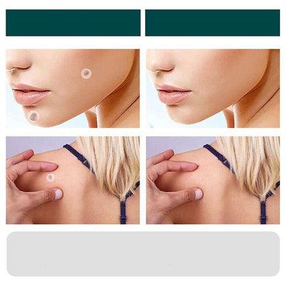 Skin Tag Patches