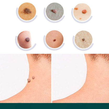 Skin Tag Patches